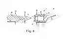 Fig. 07 - IMPLANTABLE SUPPORT ATTACHMENT SYSTEM AND ASSEMBLY