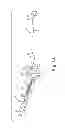 Fig. 09 - IMPLANTABLE SUPPORT ATTACHMENT SYSTEM AND ASSEMBLY