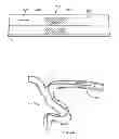 Fig. 03 - Devices and systems for thrombus treatment