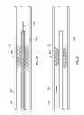 Fig. 04 - Devices and systems for thrombus treatment
