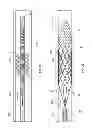 Fig. 05 - Devices and systems for thrombus treatment