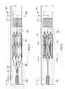 Fig. 10 - Devices and systems for thrombus treatment