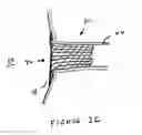 Fig. 07 - Anti-Arrhythmia Devices And Methods Of Use
