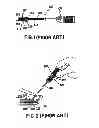 Fig. 02 - Vascular closure device anchor