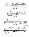 Fig. 09 - Flexible tamping member