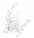 Fig. 05 - DEVICES AND METHODS FOR CLOSURE OF A PATENT FORAMEN OVALE