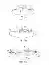 Fig. 07 - MODULATED CONSTRAINING APPARATUS AND METHODS OF USE