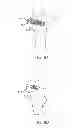 Fig. 09 - MODULATED CONSTRAINING APPARATUS AND METHODS OF USE