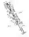 Fig. 03 - Derotation apparatus for treating spinal irregularities