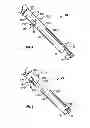 Fig. 05 - Derotation apparatus for treating spinal irregularities