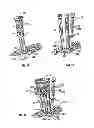 Fig. 08 - Derotation apparatus for treating spinal irregularities
