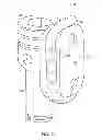 Fig. 07 - Trochanter attachment device