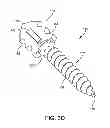 Fig. 06 - HAMMER TOE IMPLANT WITH LIVING HINGE AND METHOD