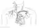 Fig. 01 - Physiological vibration detection in an implanted medical device