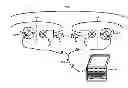 Fig. 01 - Fitting Bilateral Hearing Prostheses