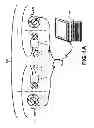 Fig. 02 - Fitting Bilateral Hearing Prostheses