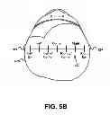 Fig. 07 - Fitting Bilateral Hearing Prostheses