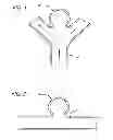 Fig. 02 - METHODS AND DEVICES FOR TREATMENT OF VASCULAR DEFECTS