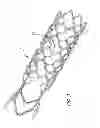 Fig. 03 - METHODS AND DEVICES FOR TREATMENT OF VASCULAR DEFECTS