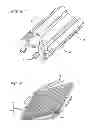 Fig. 06 - METHODS AND DEVICES FOR TREATMENT OF VASCULAR DEFECTS