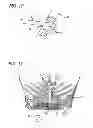 Fig. 07 - METHODS AND DEVICES FOR TREATMENT OF VASCULAR DEFECTS