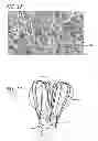 Fig. 08 - METHODS AND DEVICES FOR TREATMENT OF VASCULAR DEFECTS