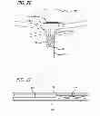 Fig. 12 - METHODS AND DEVICES FOR TREATMENT OF VASCULAR DEFECTS