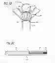 Fig. 15 - METHODS AND DEVICES FOR TREATMENT OF VASCULAR DEFECTS