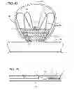 Fig. 22 - METHODS AND DEVICES FOR TREATMENT OF VASCULAR DEFECTS