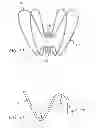 Fig. 26 - METHODS AND DEVICES FOR TREATMENT OF VASCULAR DEFECTS