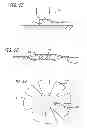 Fig. 28 - METHODS AND DEVICES FOR TREATMENT OF VASCULAR DEFECTS