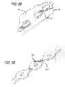 Fig. 29 - METHODS AND DEVICES FOR TREATMENT OF VASCULAR DEFECTS