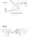 Fig. 31 - METHODS AND DEVICES FOR TREATMENT OF VASCULAR DEFECTS
