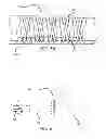Fig. 32 - METHODS AND DEVICES FOR TREATMENT OF VASCULAR DEFECTS
