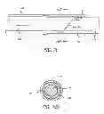 Fig. 34 - METHODS AND DEVICES FOR TREATMENT OF VASCULAR DEFECTS