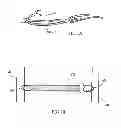 Fig. 02 - Devices and methods for deploying implantable sleeves over blood vessels
