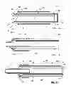 Fig. 03 - Devices and methods for deploying implantable sleeves over blood vessels
