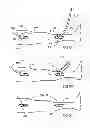 Fig. 08 - Devices and methods for deploying implantable sleeves over blood vessels