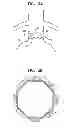 Fig. 04 - Reduced-strain extra-vascular ring for treating aortic aneurysm