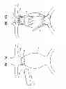 Fig. 11 - Reduced-strain extra-vascular ring for treating aortic aneurysm