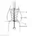Fig. 01 - CONVEYING APPLIANCE WITH VALVE LOCATING FUNCTION FOR USE DURING PERCUTANEOUS AORTIC VALVE REPLACEMENT OPERATION