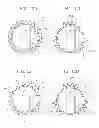 Fig. 12 - Sutureless anchoring device for cardiac valve prostheses