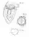 Fig. 08 - Sutureless anchoring device for cardiac valve prostheses