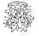 Fig. 01 - Crossbar spinal prosthesis having a modular design and related implantation methods