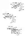 Fig. 22 - Crossbar spinal prosthesis having a modular design and related implantation methods
