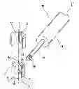 Fig. 01 - Spinal implants and related apparatus and methods