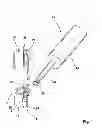 Fig. 02 - Spinal implants and related apparatus and methods