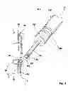 Fig. 04 - Spinal implants and related apparatus and methods