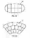 Fig. 11 - Inflatable multi-chambered devices and methods of treatment using the same