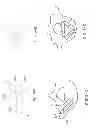 Fig. 22 - Expandable interbody spacer